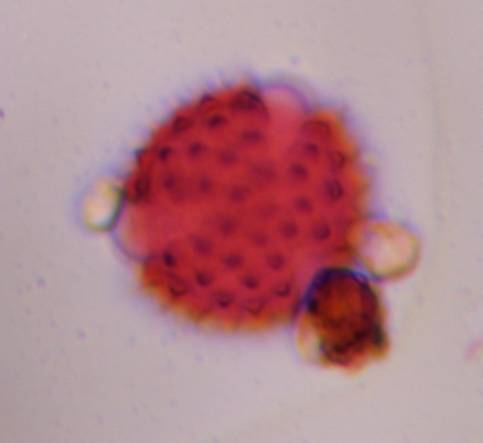 Microscope image of Asteraceae (low spine) — pollen (gallery) — verified by PollyMap