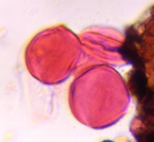 Microscope image of Unknown — pollen (gallery) — verified by PollyMap