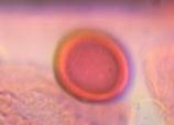 Microscope image of unidentified — pollen (gallery) — verified by PollyMap