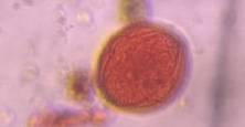 Microscope image of Maple (Acer spp.) — pollen (reference) — verified by PollyMap