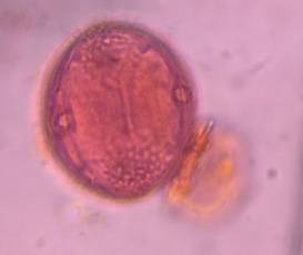 Microscope image of Olive (Olea) / Oleaceae — pollen (reference) — verified by PollyMap