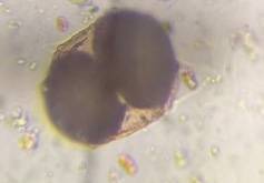 Microscope image of Pine — pollen (gallery) — verified by PollyMap