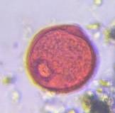 Microscope image of Mulberry — pollen (gallery) — verified by PollyMap