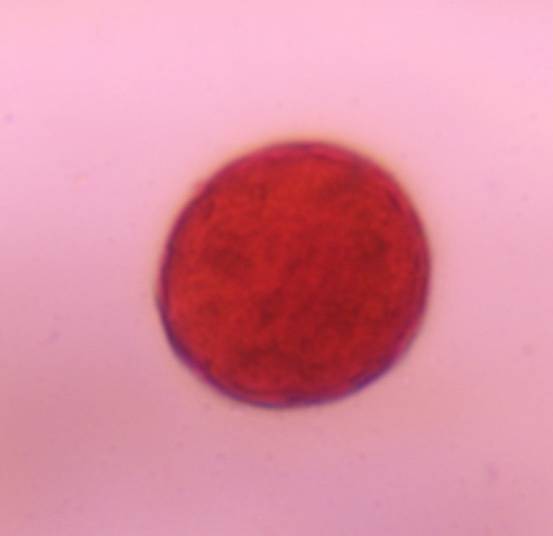 Microscope image of Chenopod — pollen (gallery) — verified by PollyMap