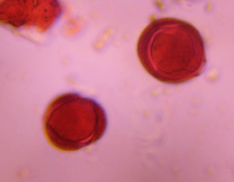 Microscope image of Astereceae (artemisia) — pollen (reference) — verified by PollyMap