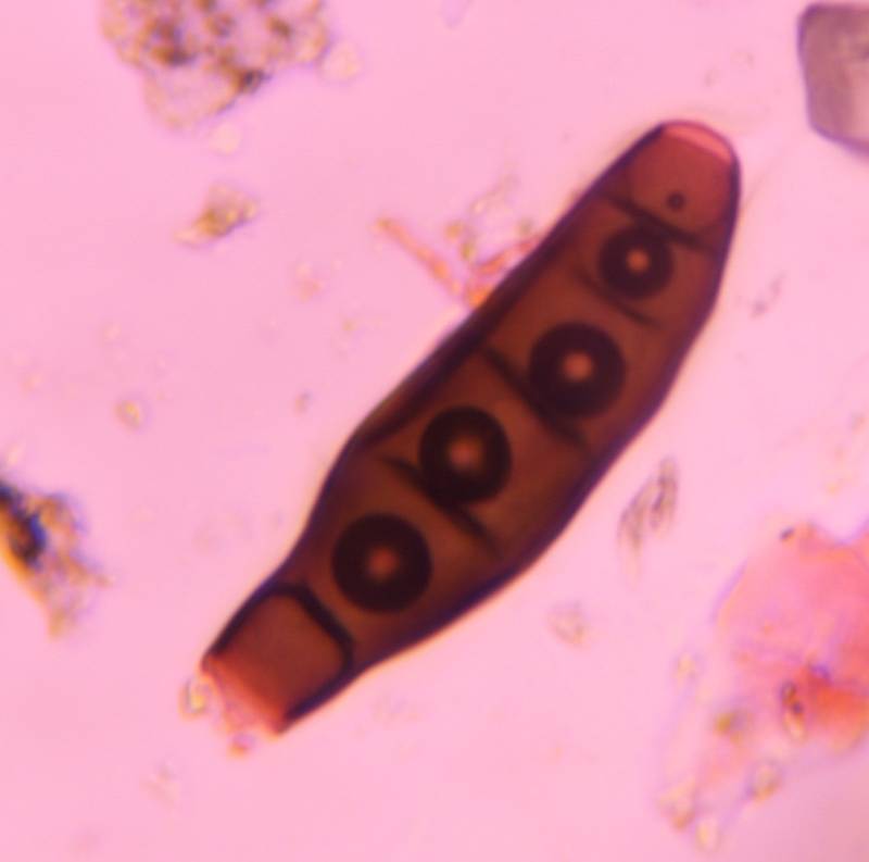 Microscope image of Bipolaris/Drechslera-type mold spore — mold (reference) — verified by PollyMap