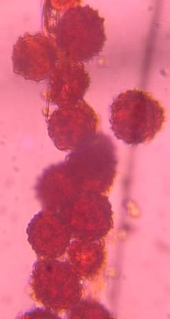 Microscope image of Asteraceae — pollen (gallery) — verified by PollyMap
