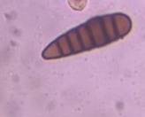 Microscope image of helminthosporium — mold (reference) — verified by PollyMap