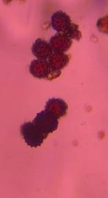 Microscope image of Asteraceae — pollen (gallery) — verified by PollyMap