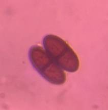 Microscope image of Botryosphaeriaceae conidium (e.g., Diplodia/Lasiodiplodia) — mold (reference) — verified by PollyMap