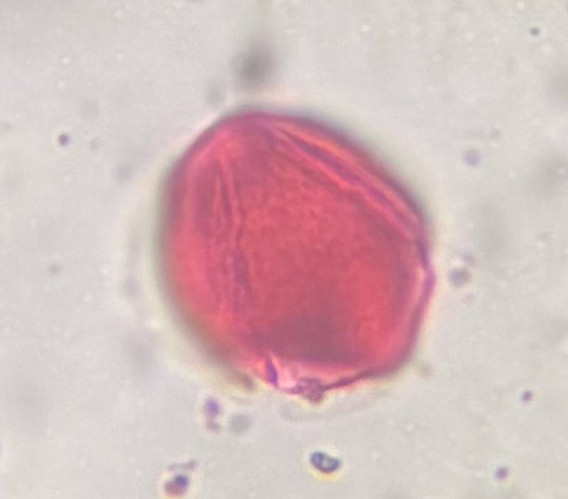 Microscope image of Artemisia — pollen (gallery) — verified by PollyMap