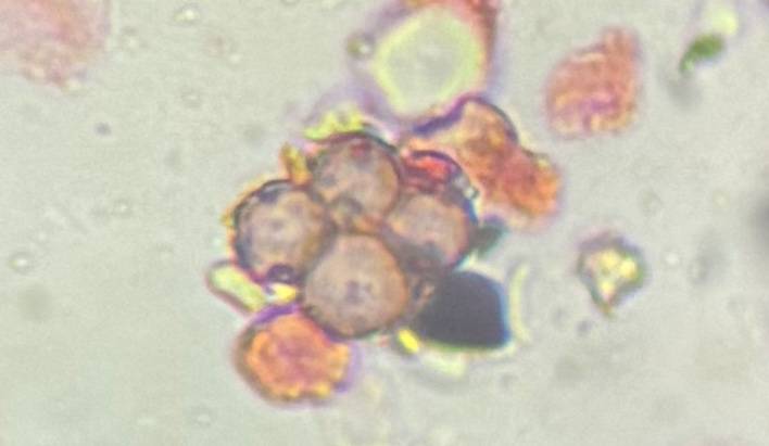 Microscope image of Epicoccum — mold (reference) — verified by PollyMap