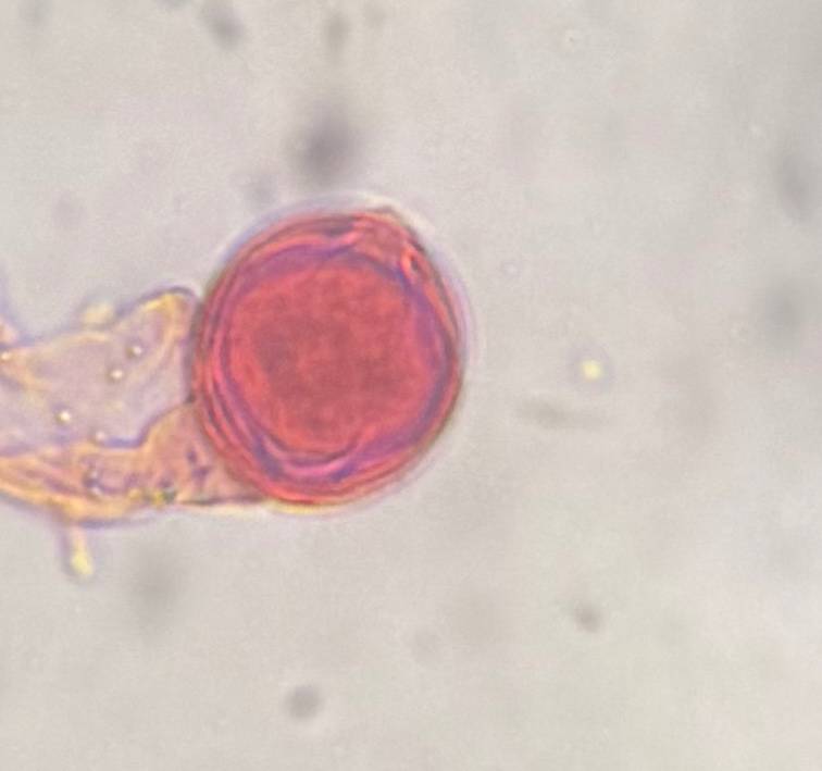 Microscope image of Artemisia — pollen (reference) — verified by PollyMap