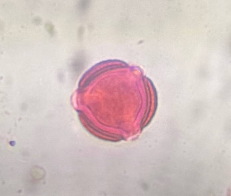 Microscope image of Artemisia — pollen (gallery) — verified by PollyMap