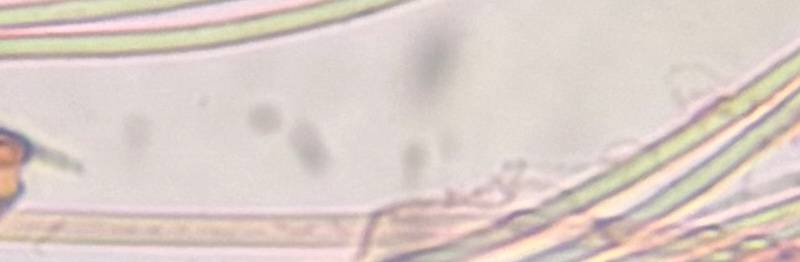 Microscope image of unidentified fungus — mold (gallery) — verified by PollyMap
