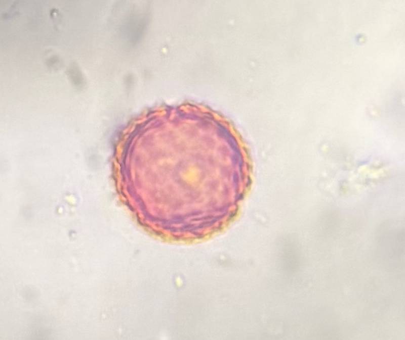 Microscope image of Asteraceae — pollen (gallery) — verified by PollyMap