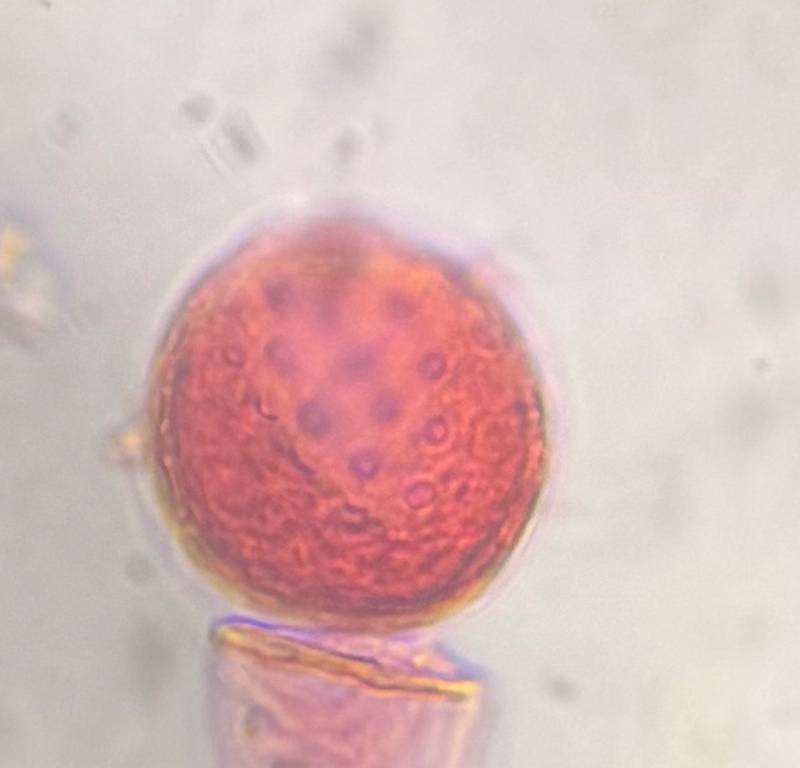 Microscope image of Chenopod — pollen (gallery) — verified by PollyMap