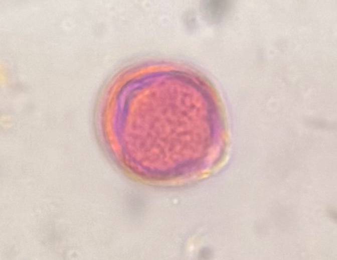 Microscope image of Artemisia — pollen (gallery) — verified by PollyMap