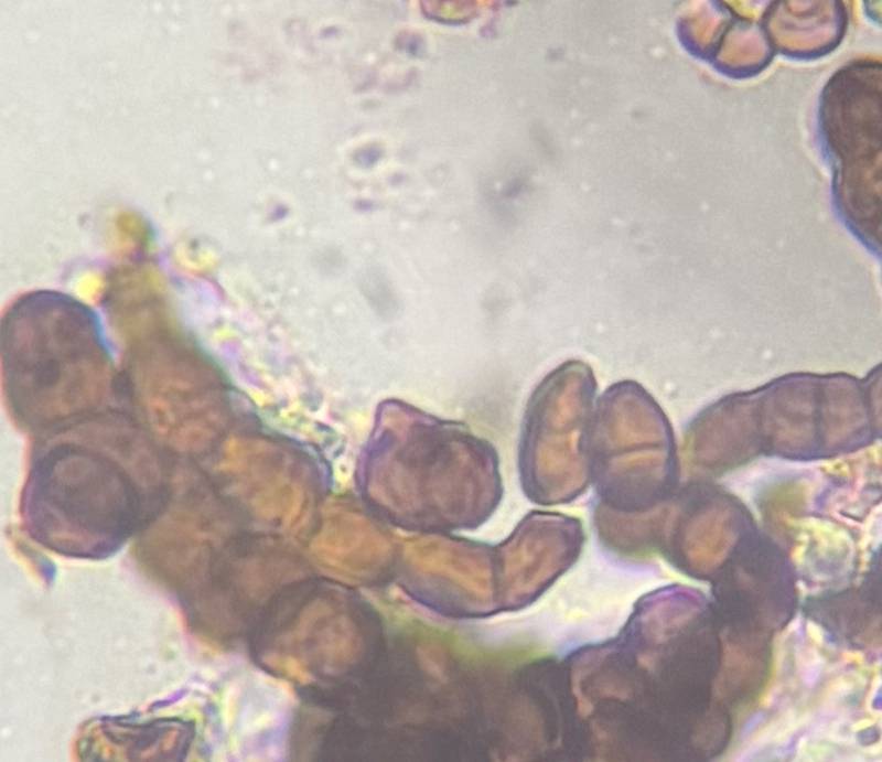 Microscope image of unidentified fungus — mold (reference) — verified by PollyMap