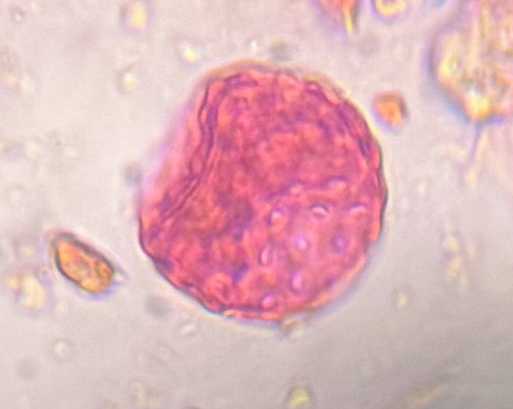 Microscope image of Chenopod — pollen (gallery) — verified by PollyMap