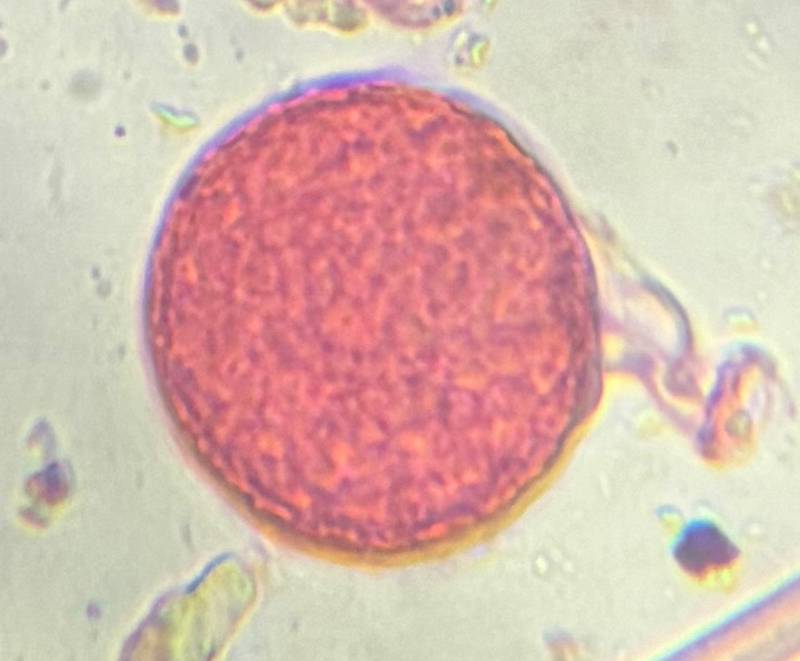 Microscope image of Chenopod — pollen (gallery) — verified by PollyMap