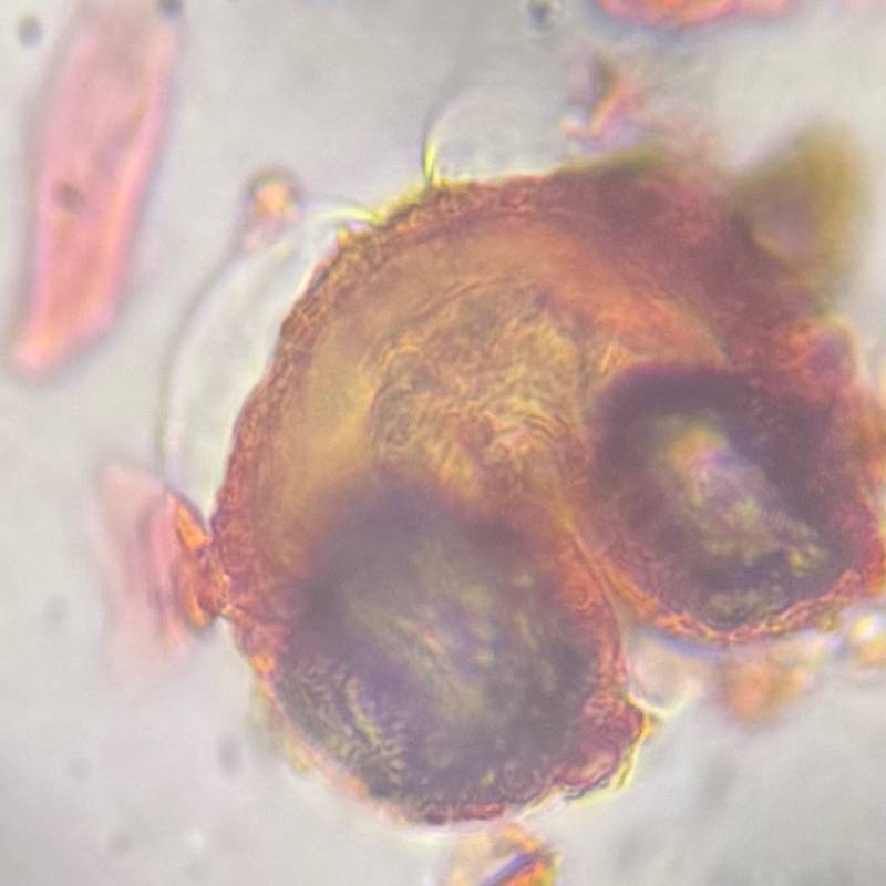 Microscope image of Pine — pollen (gallery) — verified by PollyMap