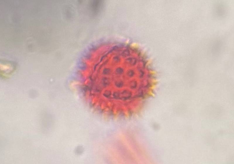 Microscope image of Asteraceae — pollen (gallery) — verified by PollyMap