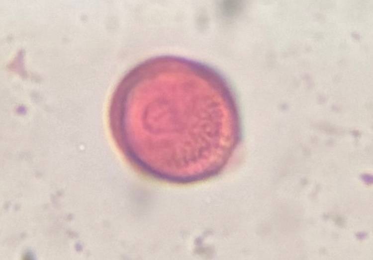 Microscope image of Artemisia — pollen (gallery) — verified by PollyMap