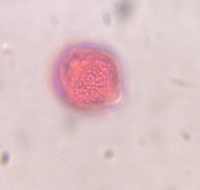 Microscope image of Artemisia — pollen (gallery) — verified by PollyMap