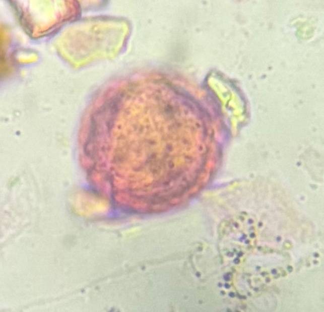 Microscope image of Chenopod — pollen (gallery) — verified by PollyMap