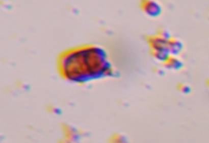 Microscope image of Rust teliospore — mold (gallery) — verified by PollyMap