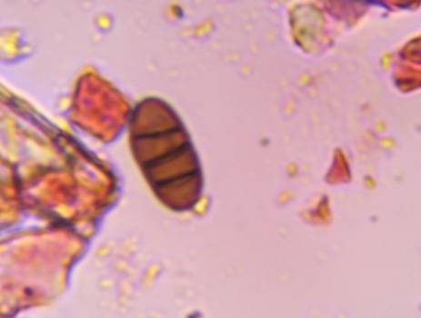 Microscope image of Bipolaris/Drechslera — mold (reference) — verified by PollyMap