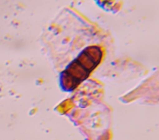 Microscope image of Bipolaris/Drechslera — mold (gallery) — verified by PollyMap