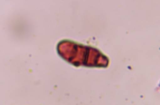Microscope image of Curvularia — mold (gallery) — verified by PollyMap