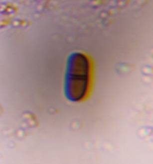 Microscope image of Didymospore — mold (reference) — verified by PollyMap