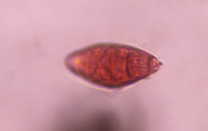 Microscope image of Bipolaris/Drechslera — mold (gallery) — verified by PollyMap