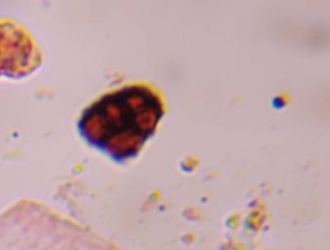 Microscope image of Epicoccum — mold (gallery) — verified by PollyMap