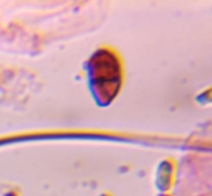 Microscope image of Rust teliospore — mold (reference) — verified by PollyMap