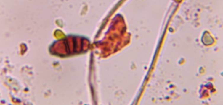 Microscope image of Curvularia — mold (gallery) — verified by PollyMap