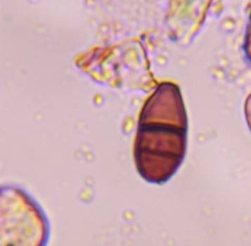 Microscope image of Curvularia — mold (gallery) — verified by PollyMap