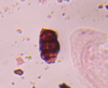 Microscope image of Pithomyces — mold (gallery) — verified by PollyMap