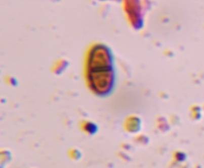 Microscope image of Dematiaceous ascospore — mold (reference) — verified by PollyMap