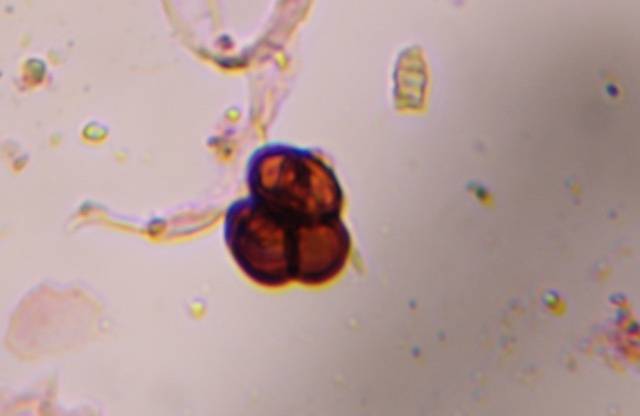 Microscope image of Epicoccum — mold (gallery) — verified by PollyMap
