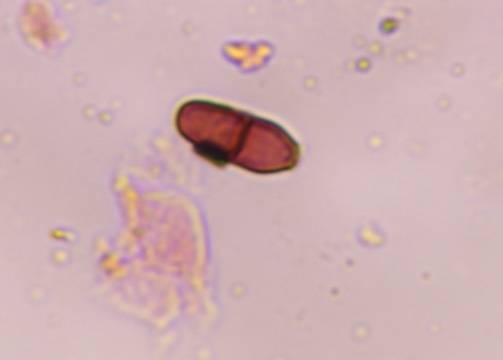 Microscope image of Ascospore — mold (reference) — verified by PollyMap