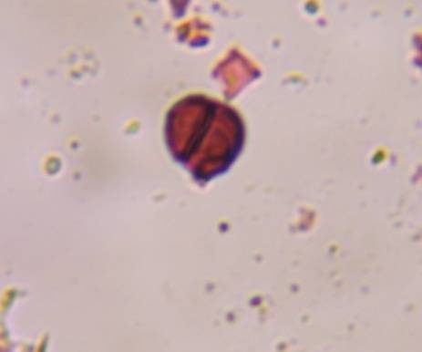 Microscope image of Unknown — mold (reference) — verified by PollyMap