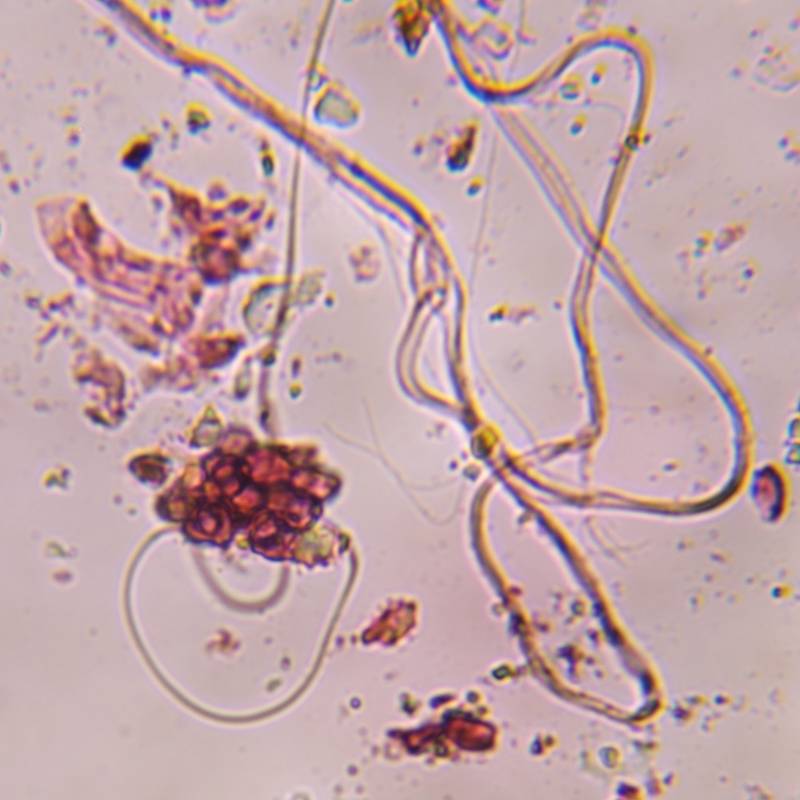 Microscope image of Epicoccum — mold (gallery) — verified by PollyMap