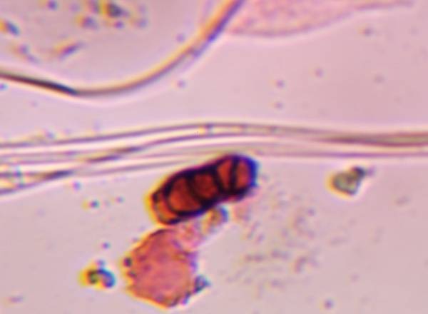 Microscope image of Bipolaris/Drechslera — mold (gallery) — verified by PollyMap