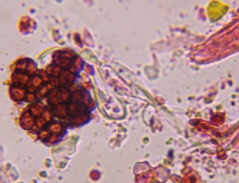 Microscope image of Epicoccum — mold (gallery) — verified by PollyMap