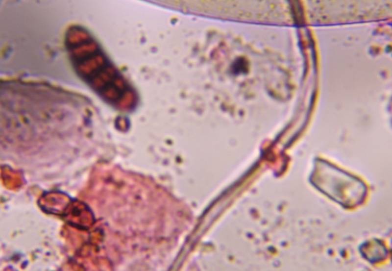 Microscope image of Bipolaris/Drechslera — mold (gallery) — verified by PollyMap