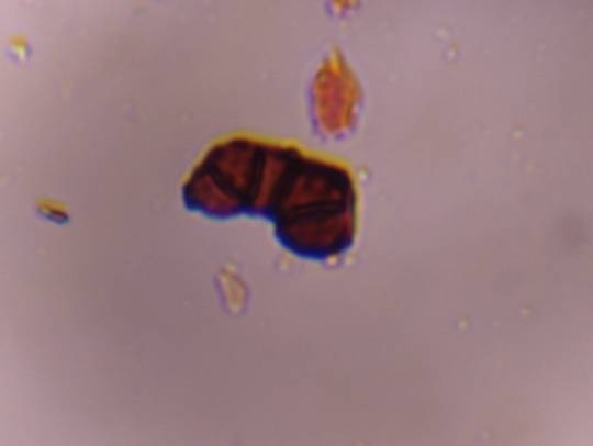 Microscope image of Curvularia — mold (gallery) — verified by PollyMap